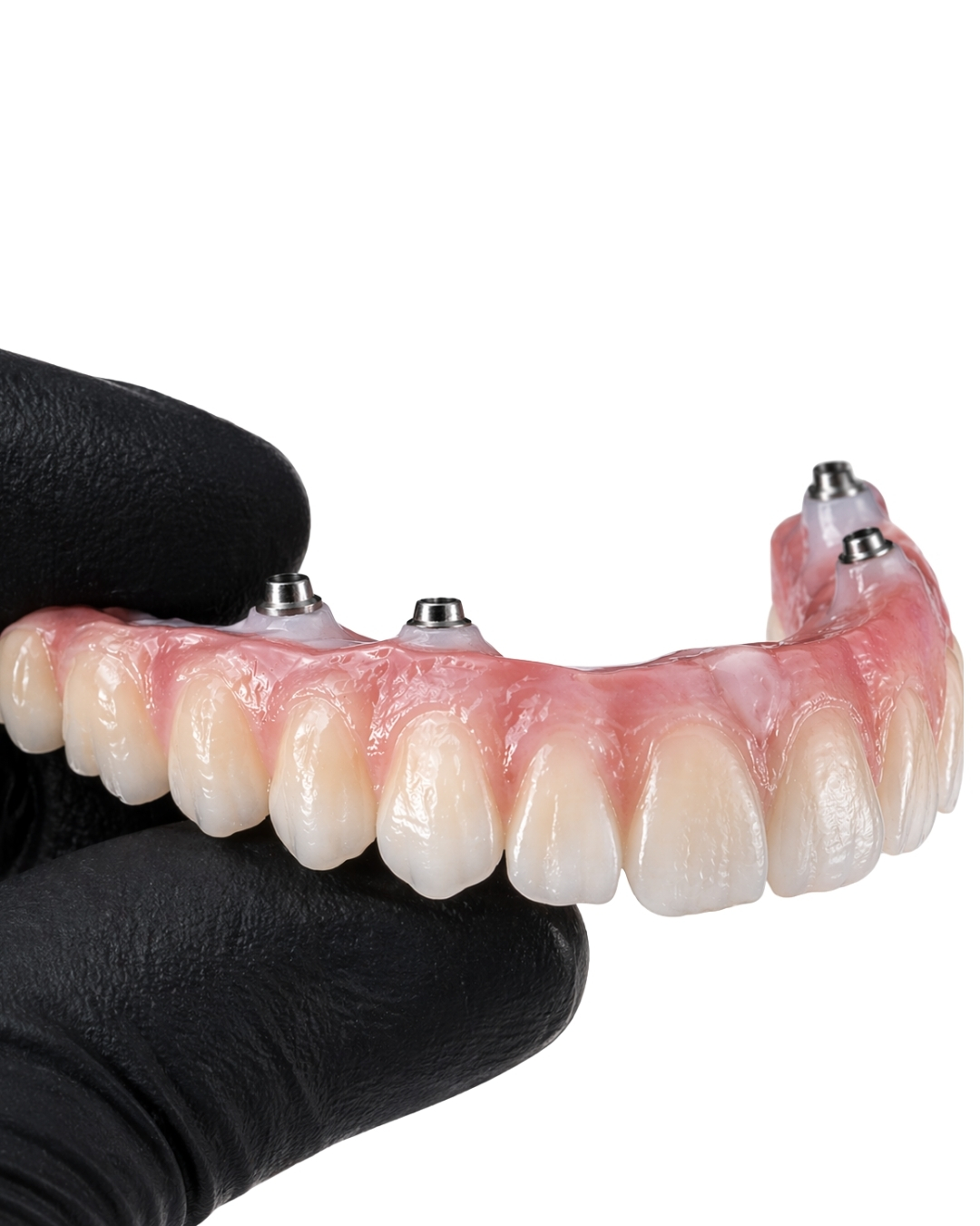Full-Arch Implant  -  product